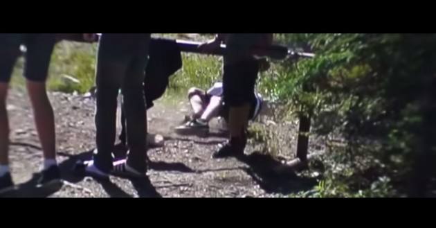Fractura de pierna fue grabada en cámara lenta (Video)