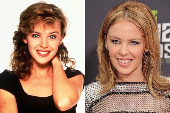 kylie-minogue