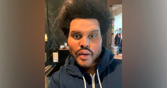 WTF: ¿The Weeknd se hizo una cirugía plástica extrema para su nuevo video?