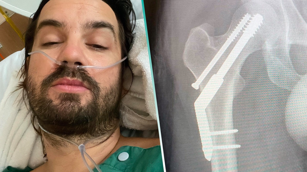 Kevin Parker se fractura la cadera pero decide continuar con la gira de Tame Impala